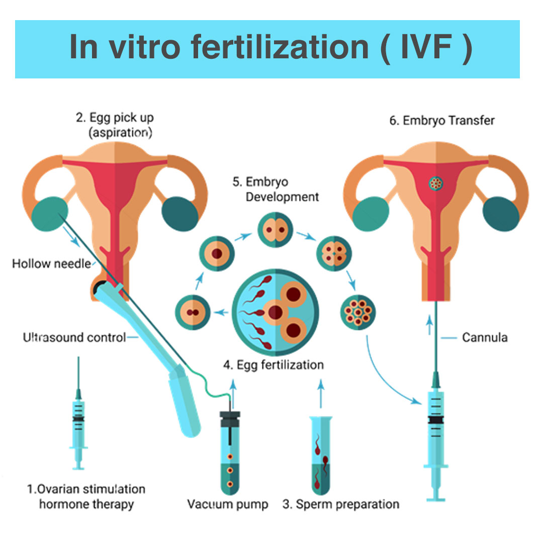What are IVF and test-tube babies?