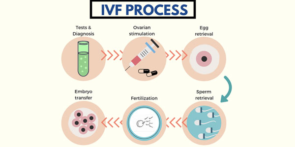 test tube baby - What's the procedure of IVF?
