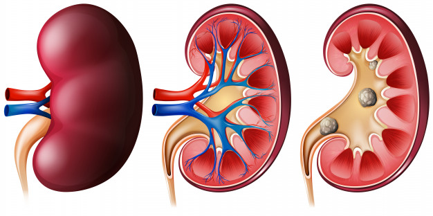 Gokshura Benefits for Kidney Problems
