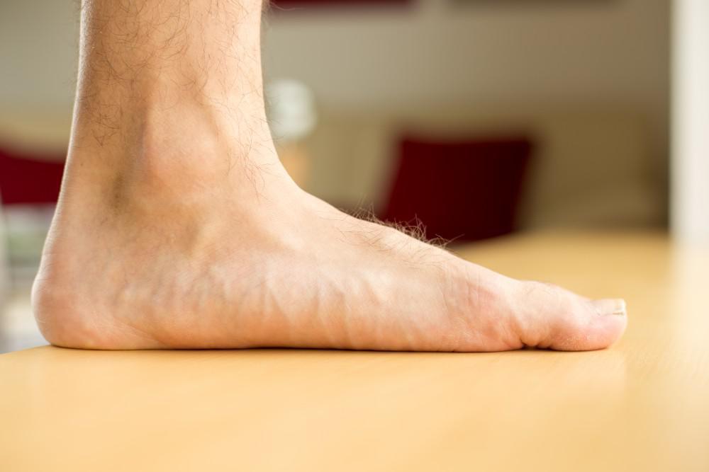What are flat feet?