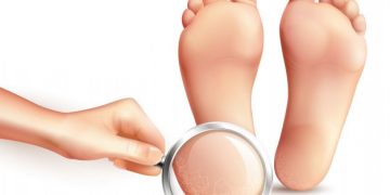 Foot Cream for Cracked Heels