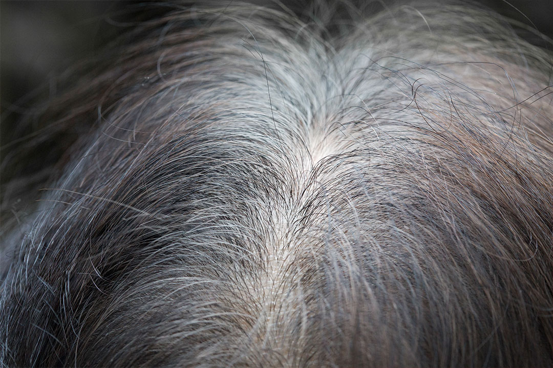 Why Does Grey Hair Turn Brassy?