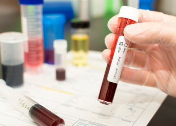 Union Health Minister Asked to Increase Dengue Testing in Delhi