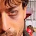 Tiger Shroff suffers eye injury while shooting for Ganapath in UK, shares pic