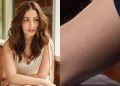Everything You Need to Know About the Skin Disease Yami Gautam is Battling With