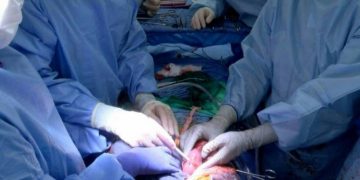 Another Pig to Human Kidney Transplant Becomes a Huge Success by US Medical Team