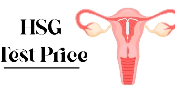 HSG Test Price, Location & Process in Chandigarh