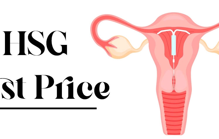 HSG Test Price, Location & Process in Chandigarh